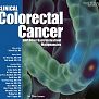 COVID-19 and the Global Impact on Colorectal Practice and Surgery